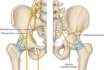 Hip Radiofrequency Ablation